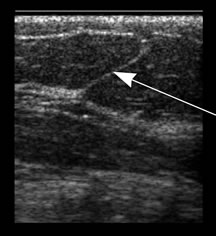 Ultrasound Exam: Anatomy Figure